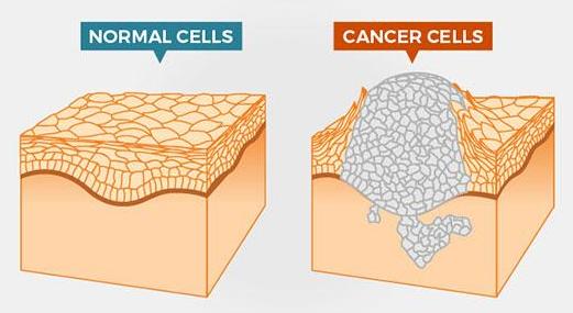 Cancer-and-Normal-Cells